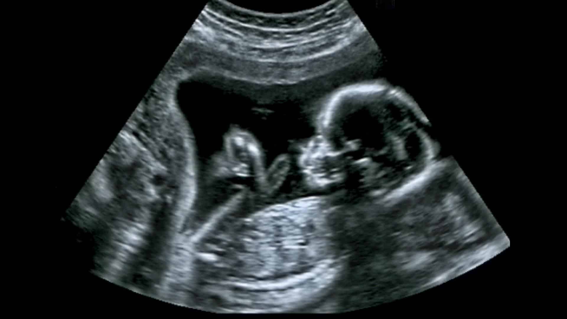 Bebê em imagem de ultrassom