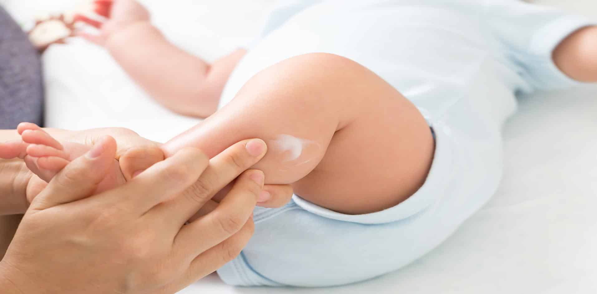 Aplicação de produto dermatológico em bebê